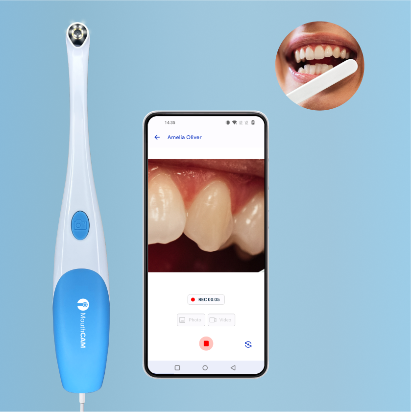 USB Personal Dental Intraoral Camera