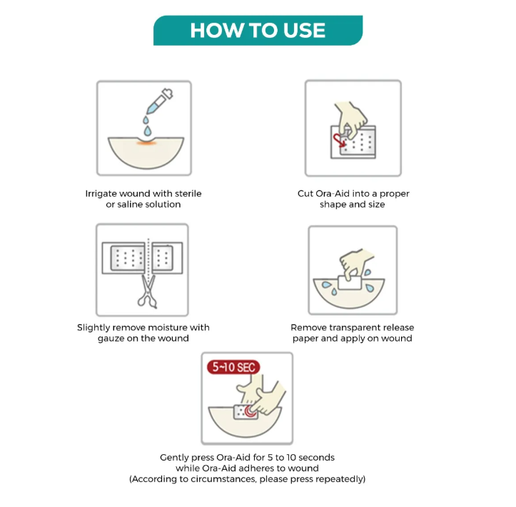 Ora-Aid – intraoral wound dressing