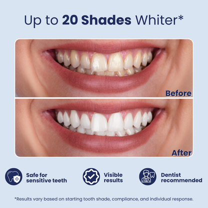 Dentulu 6D Whitening Strips - Dental Whitening Kit