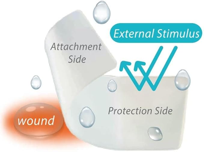 Ora-Aid – intraoral wound dressing